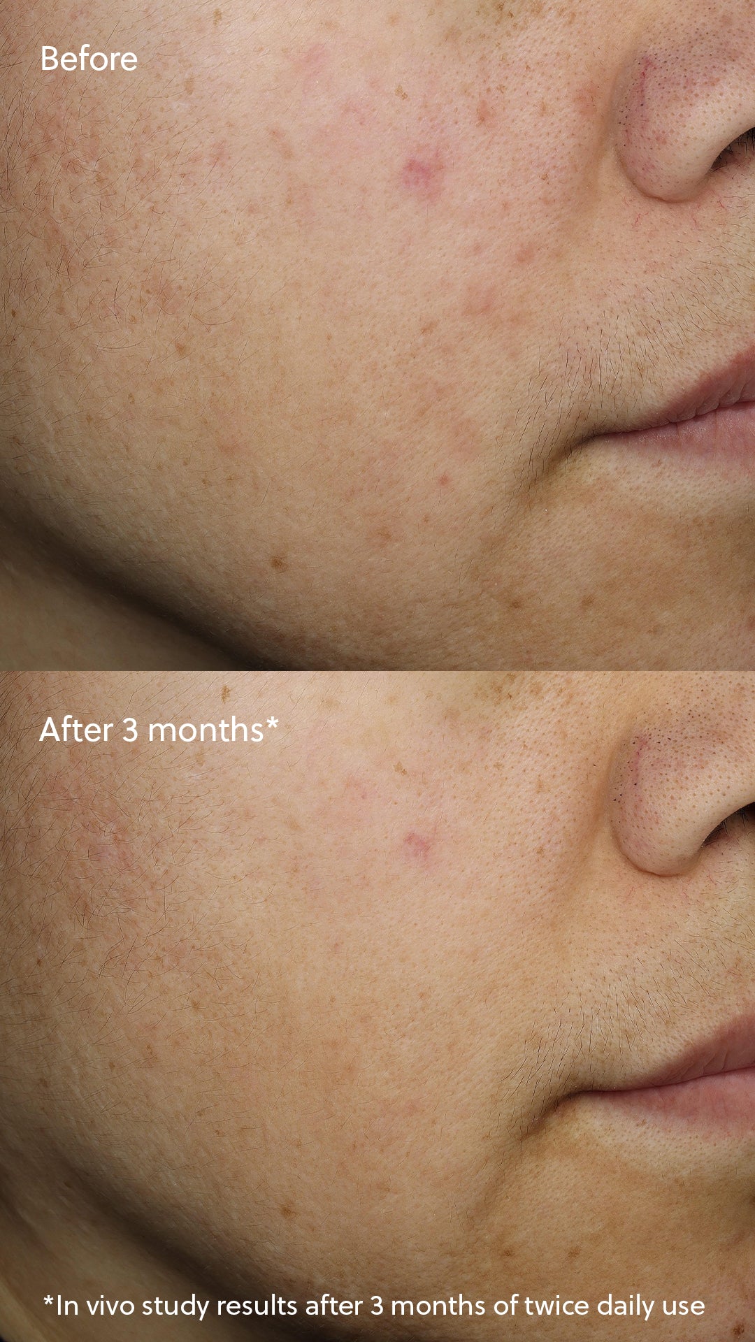 Vitamin C+ Serum