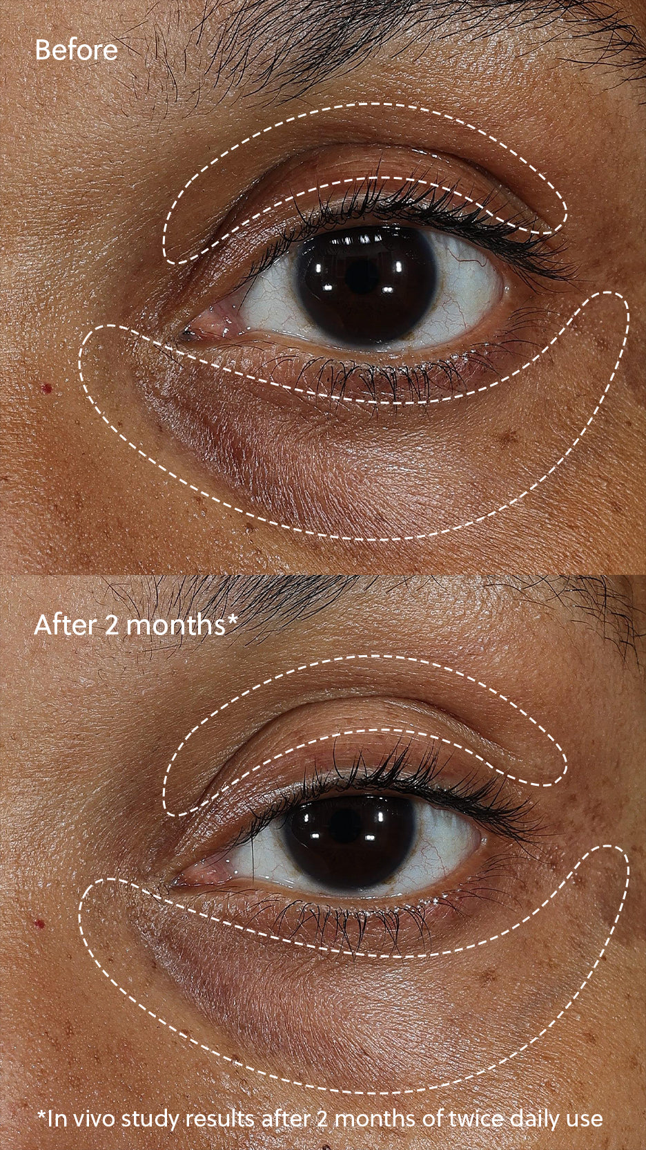 Vitamin C+ Eye Cream