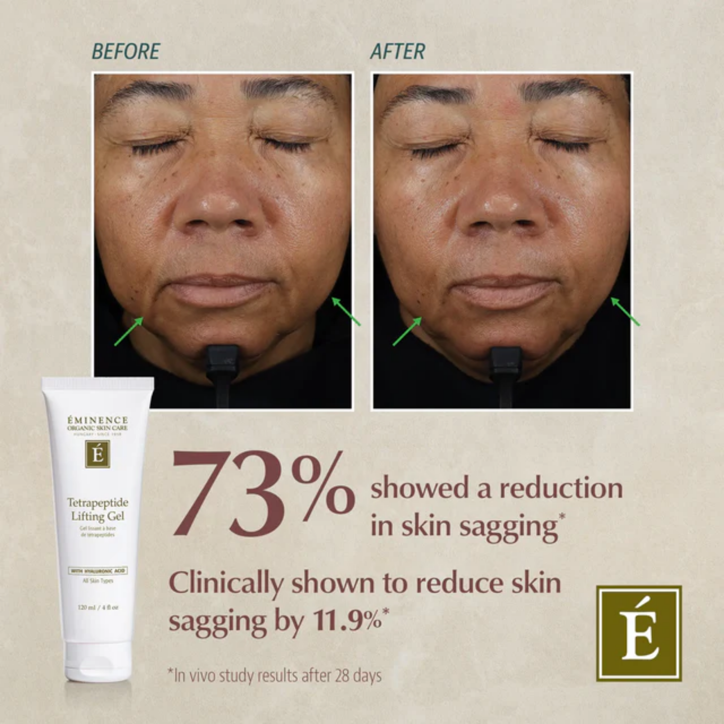 Eminence Organics Advanced Firming Bundle